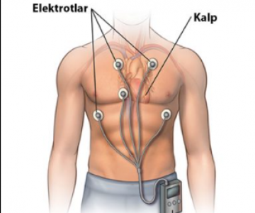 Holter